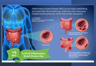 About inflammatory bowel disease